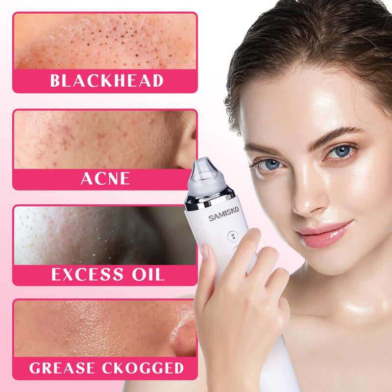 Advanced pore vacuum blackhead remover for face with magnified HD camera and adjustable suction levels