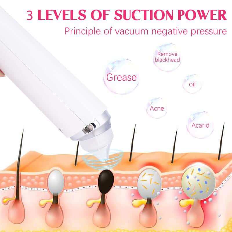 Advanced Pore Vacuum Black Head Remover with magnified camera and multiple suction levels for clear skin
