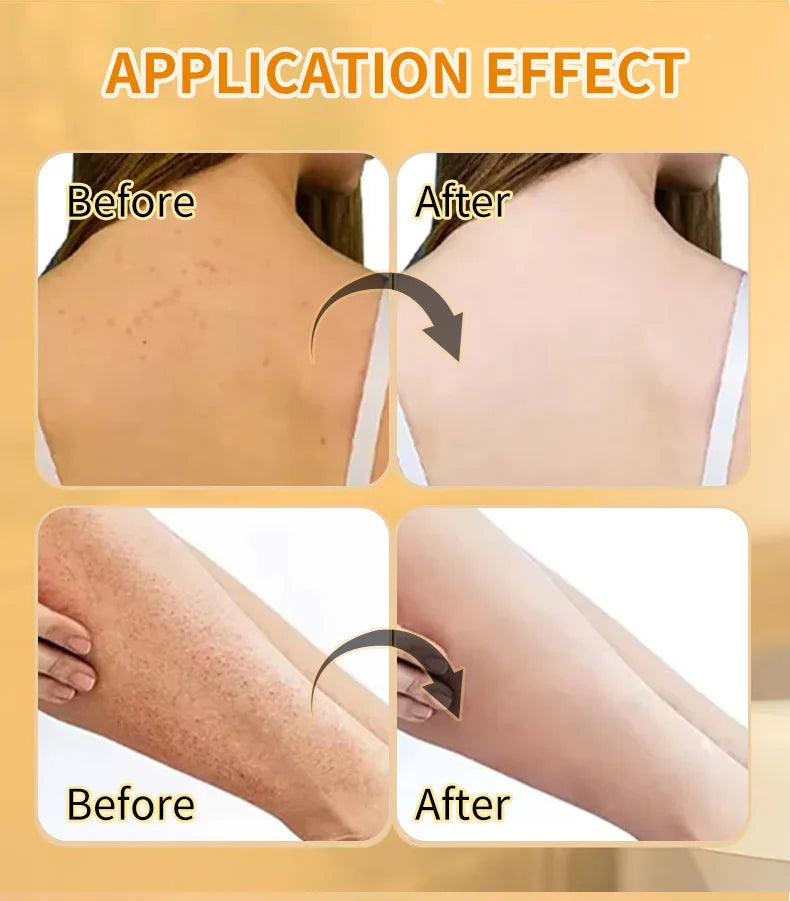 VC & Turmeric Exfoliating Body Scrub Whitening Brightening Remove Dead Skin Nourish Smooth Body Cleanser Skin Care