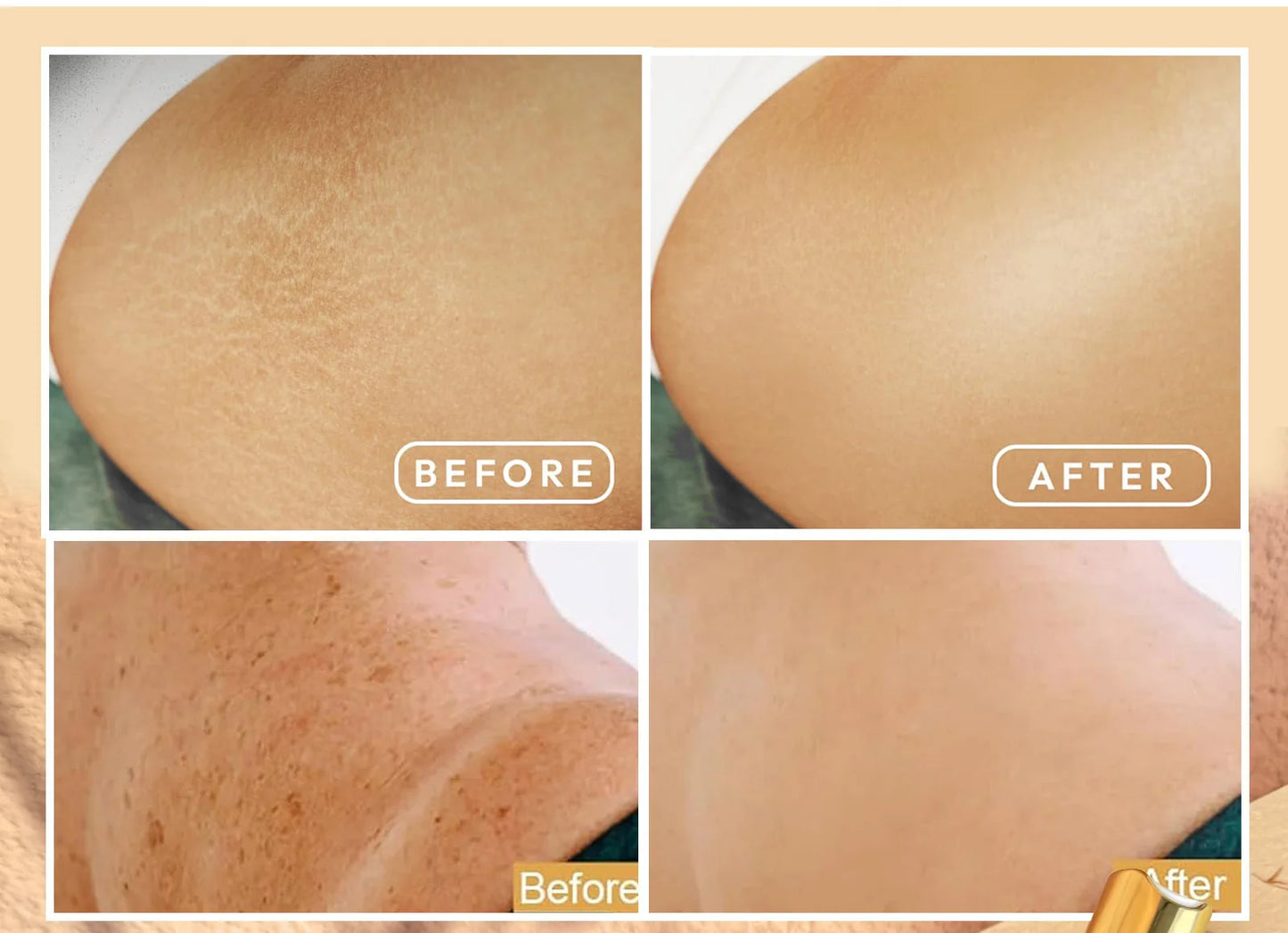 WK JALY Whitening Essential Body Oil Series, Clean Skin, Moisturizing, Nourishing, Remove Acne, Black Spots, for All Skin Types