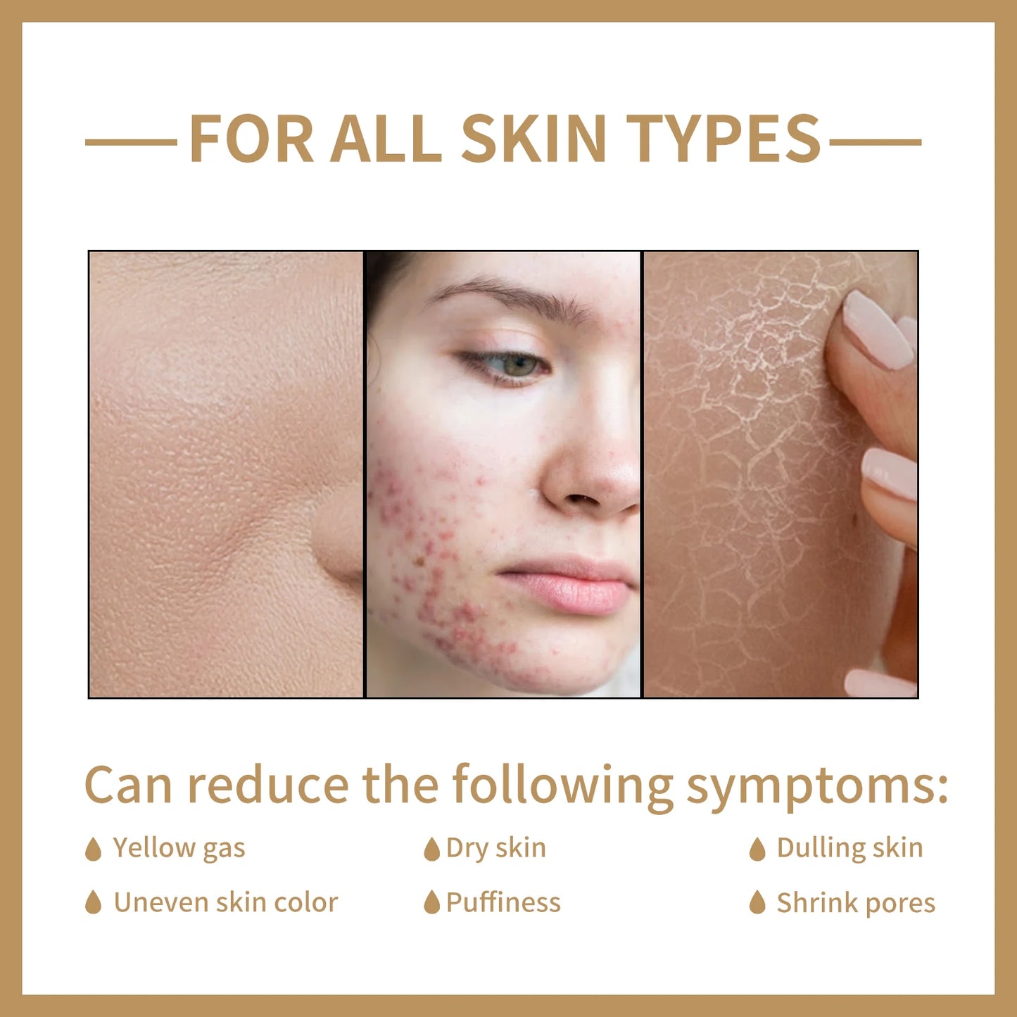 Rice Water Face Toner Essence Deep Moisturizing Repairing Skin Barrier Shrink Pore Brightening Anti Aging Nourishing Toner 150ml