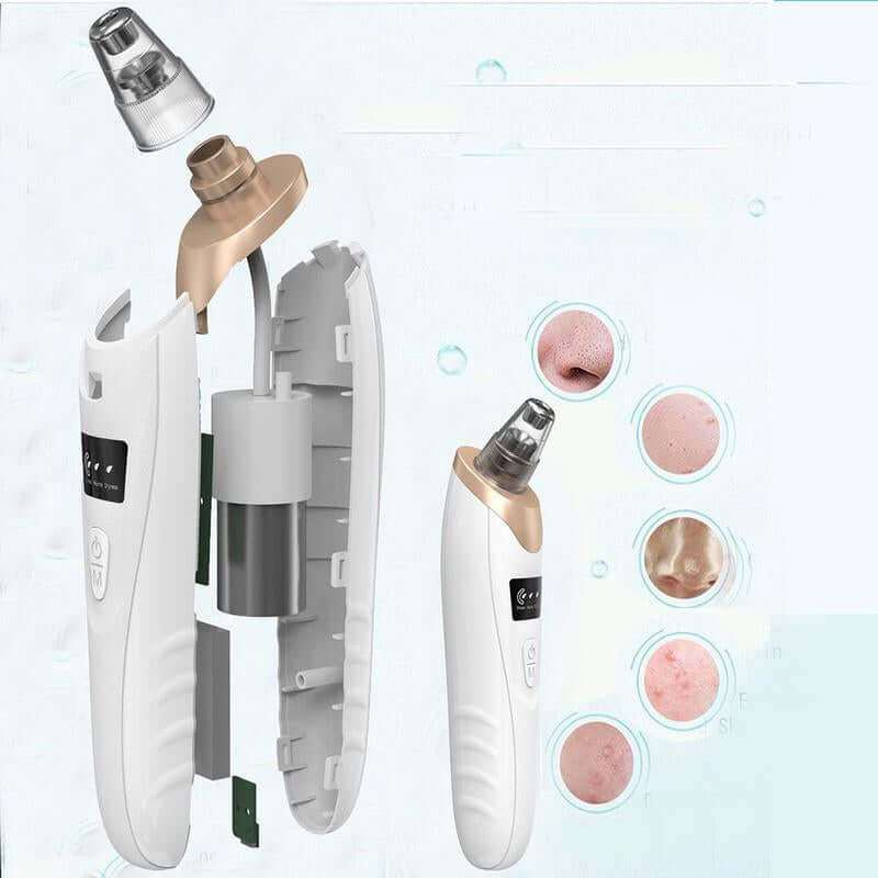 Pro Pore Vacuum Cleaner with digital display, multiple suction levels, and interchangeable probes for deep blackhead removal and skin cleansing.