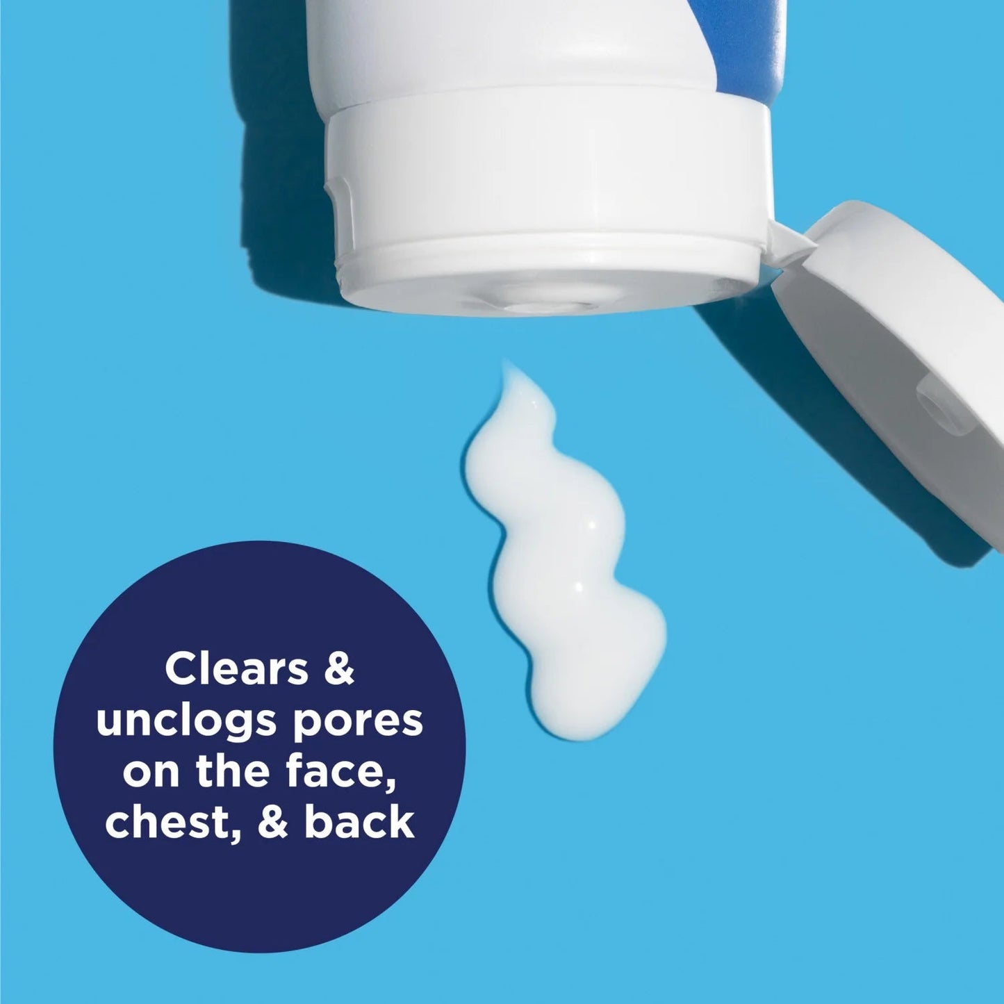 4% Benzoyl Peroxide acne creamy wash for clear skin and acne treatment