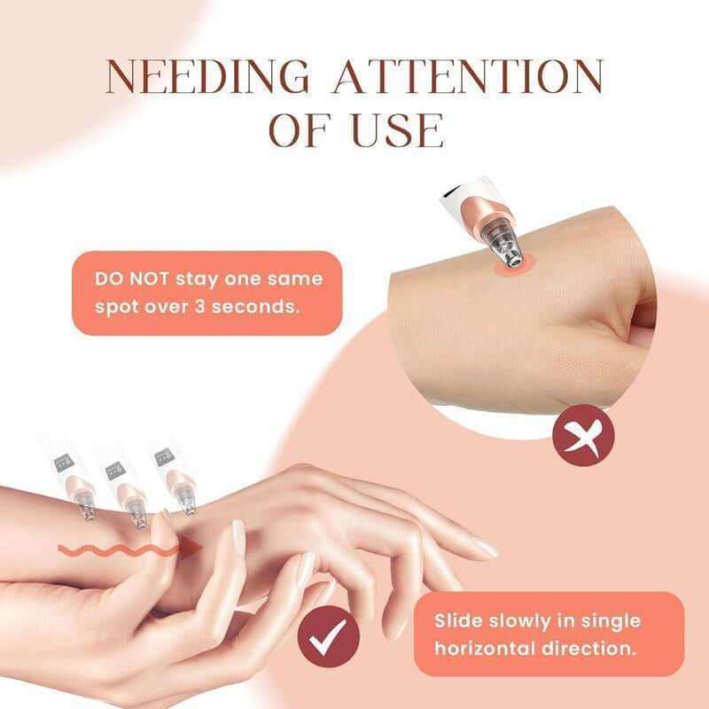 Pro Pore Vacuum Cleaner blackhead remover with 3 suction levels and 5 probes for deep pore cleansing